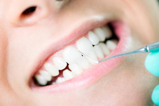preventative dentistry in edmonton