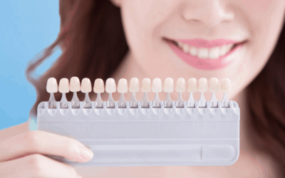 everything you need to know about teeth whitening