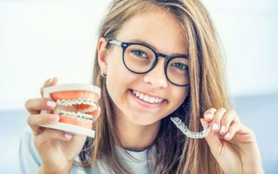 The 5 Most Commonly Asked Questions About Invisalign - Banff