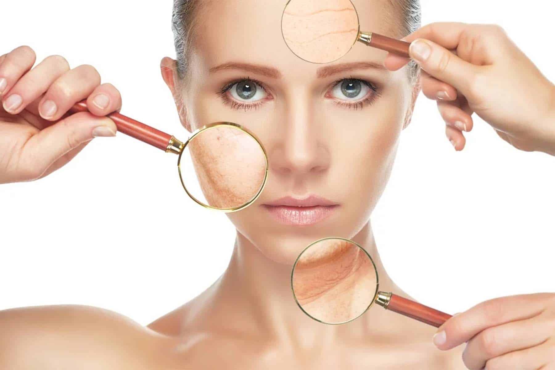 Cosmetic Botox in Edmonton